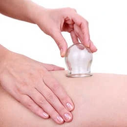 Cuppingmassage